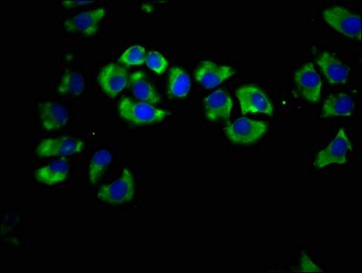 LIPH Antibody