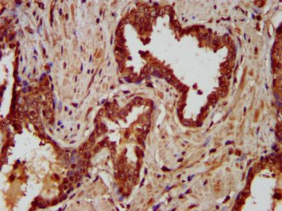 LIPH Antibody