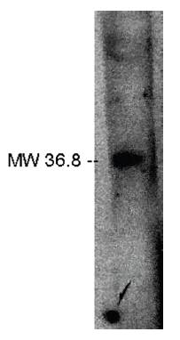 Rabbit Human Lipid Phosphate Phosphatase Related Protein 2 Antibody