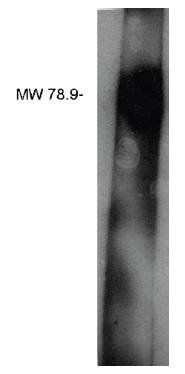 Rabbit Human Lipid Phosphate Phosphatase Related Protein 3 Antibody