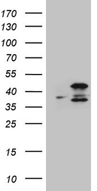 Lipin 1 Antibody