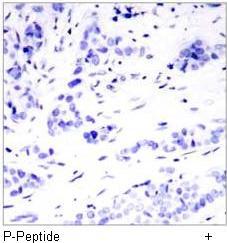 Polyclonal Antibody against Human Lipocalin-2 (LCN2)