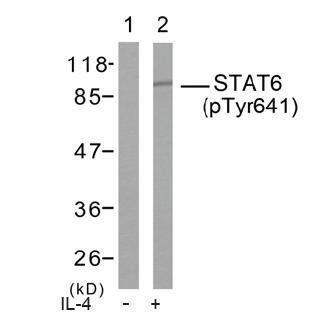 Polyclonal Antibody against Human Lipocalin-2 (LCN2)