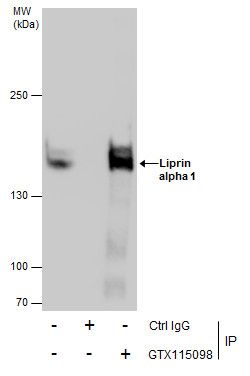 Liprin alpha 1 antibody [N1N2], N-term