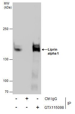 Liprin alpha 1 antibody