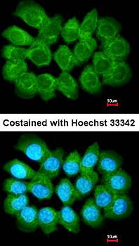 Liprin alpha 1 antibody