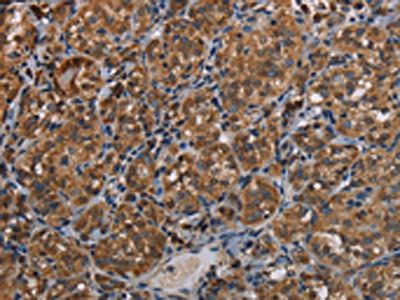 LLGL1 Antibody
