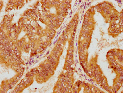 LLGL1 Antibody