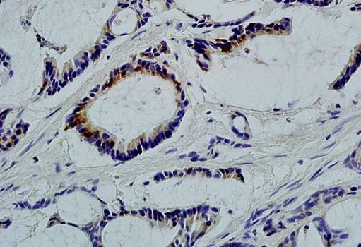LLGL1 Rabbit Polyclonal Antibody