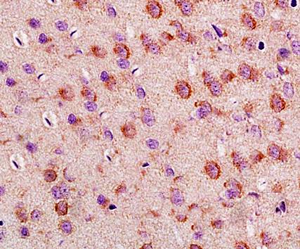 LLGL1 Rabbit Polyclonal Antibody