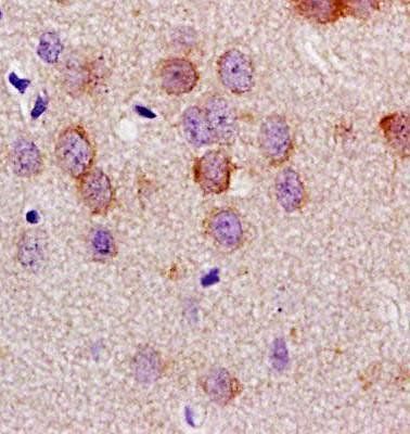 LLGL1 Rabbit Polyclonal Antibody