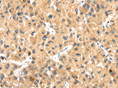 LLGL2 Antibody