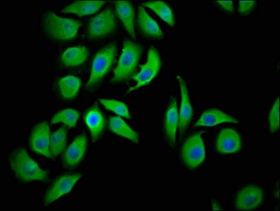 LMCD1 Antibody