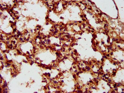 LMCD1 Antibody