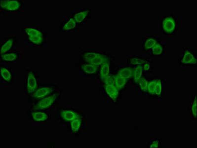 LMNB2 Antibody