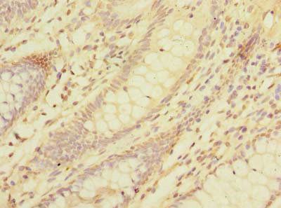 LMO3 Antibody