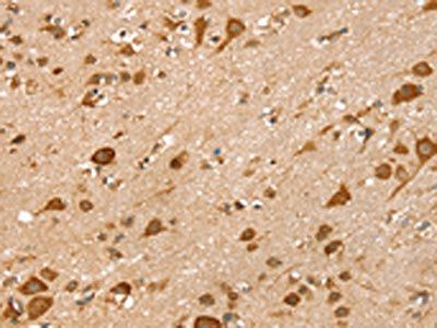 LMO4 Antibody