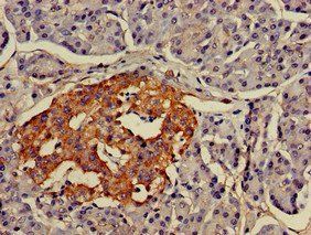 LMX1A Antibody