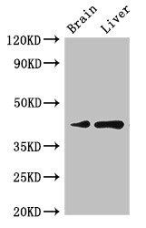 LMX1A Antibody