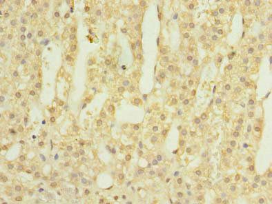 BORCS5 Antibody