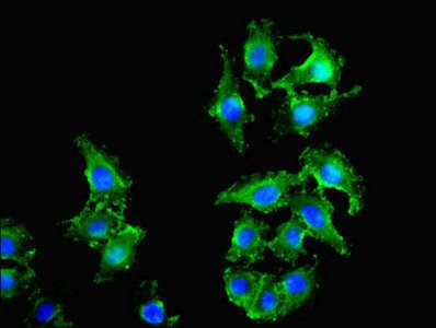 LOX-1 antibody