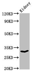 LOX-1 antibody