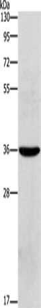 LOX-1 antibody