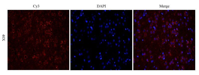 LOX-1 antibody