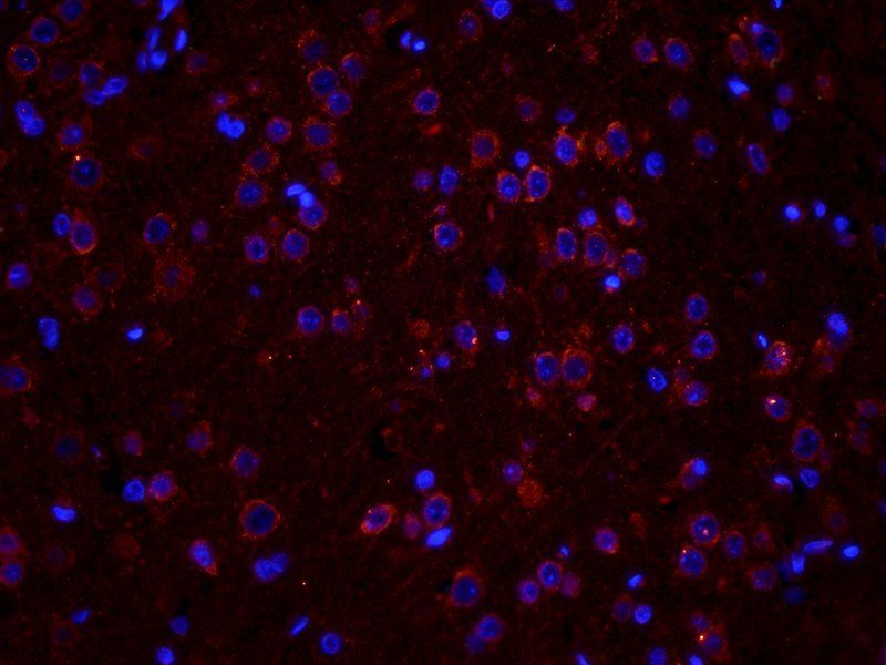 LOX-1 antibody