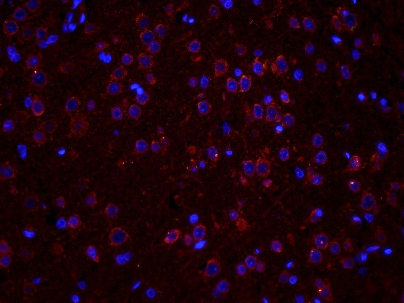 LOX-1 antibody