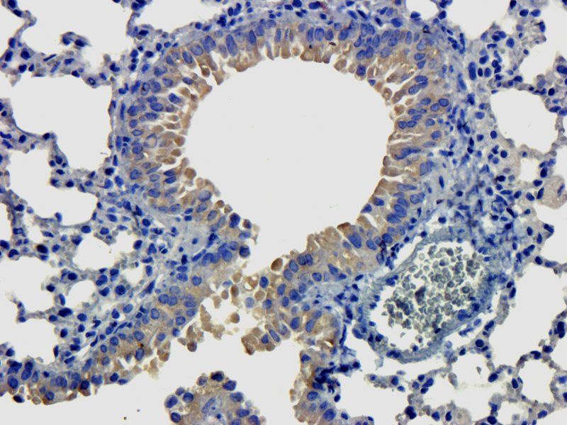 LOX-1 antibody