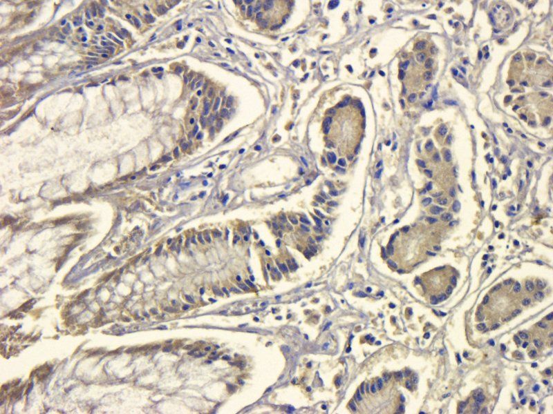 LOX-1 antibody