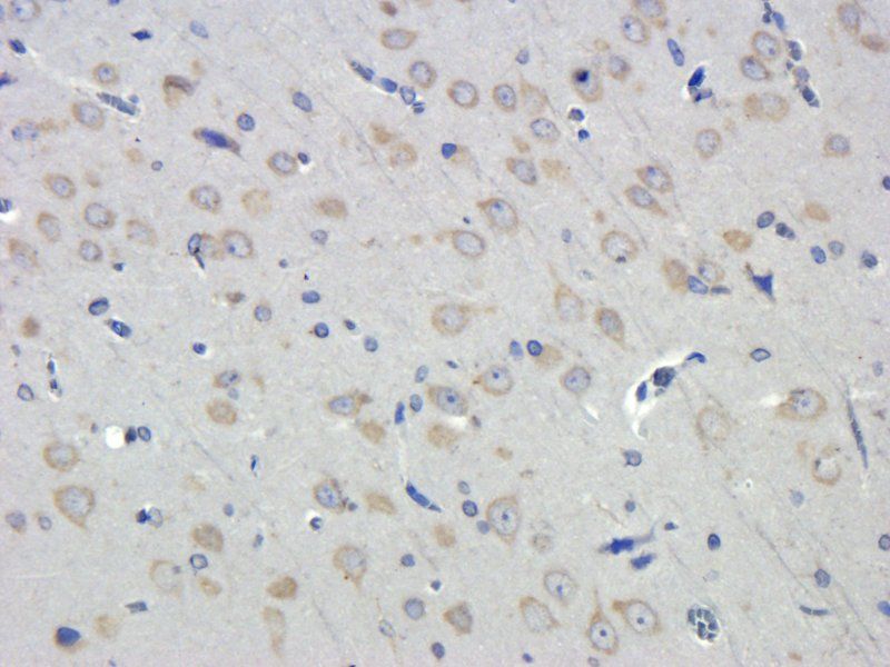 LOX-1 antibody