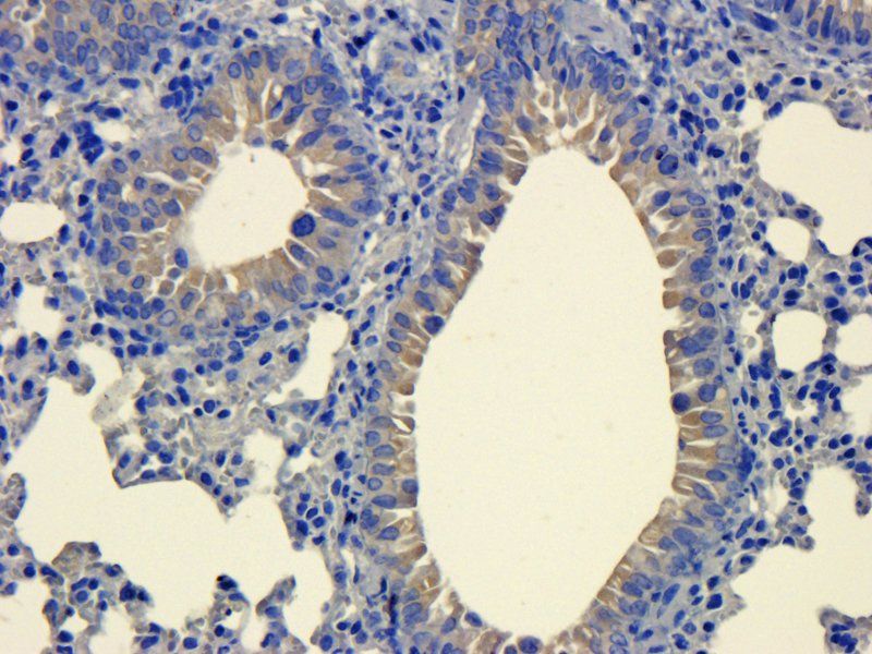 LOX-1 antibody