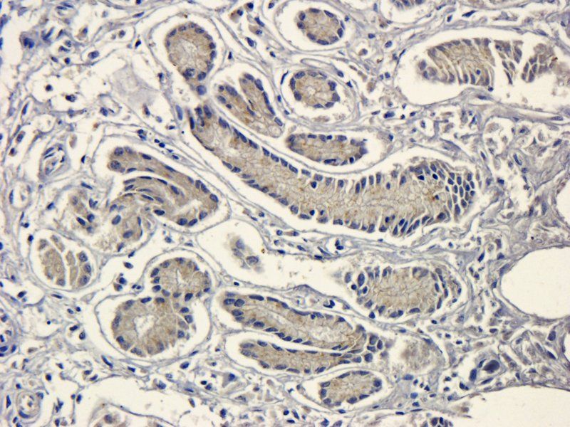 LOX-1 antibody