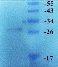 LOX-1 antibody