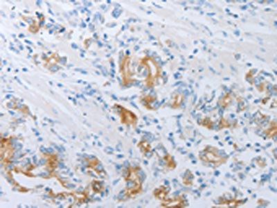LOX Antibody