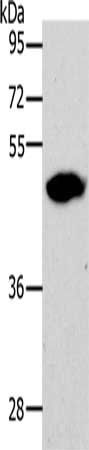 LOX Antibody