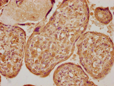 LOX Antibody