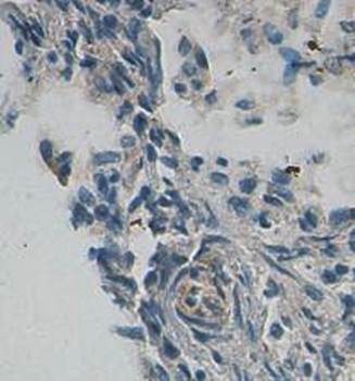 LOXL1 Rabbit Polyclonal Antibody