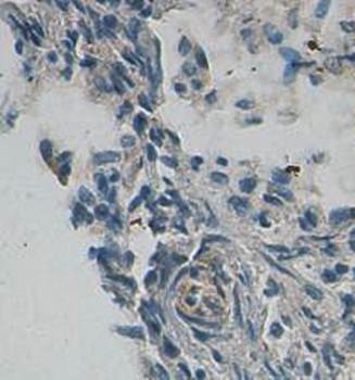 LOXL1 antibody