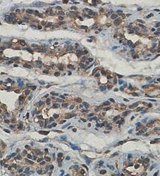LOXL1 Rabbit Polyclonal Antibody