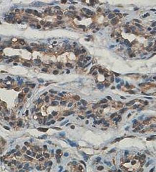 LOXL1 antibody