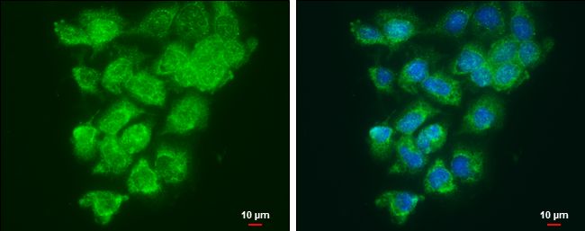 lysyl oxidase like 2 Antibody