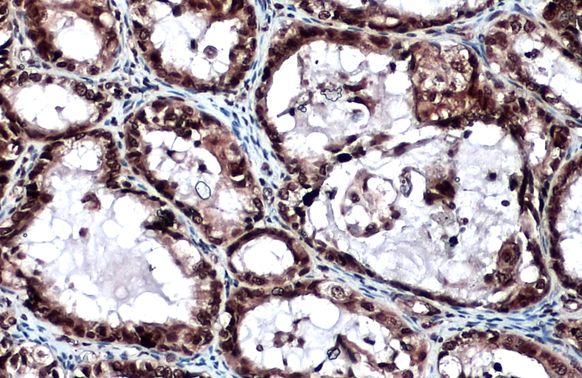 LOXL2 antibody
