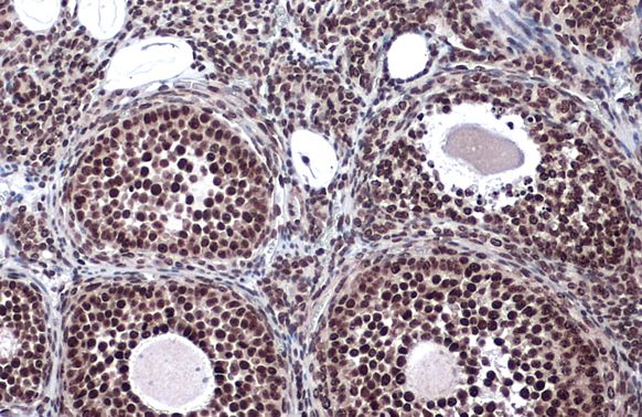 LOXL2 antibody
