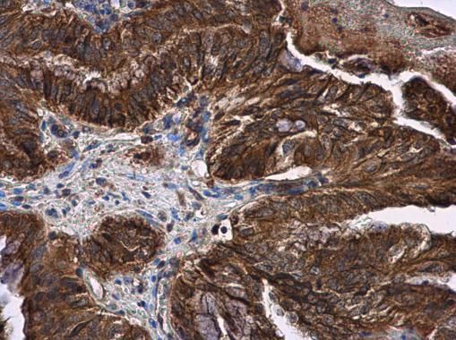 LOXL2 antibody