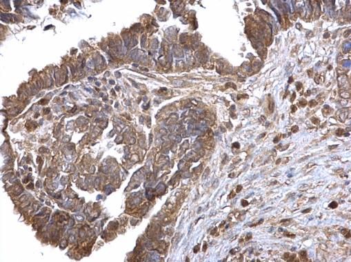 LOXL2 antibody
