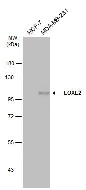 lysyl oxidase like 2 Antibody