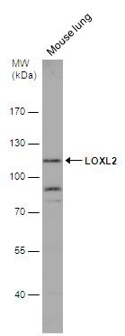 lysyl oxidase like 2 Antibody